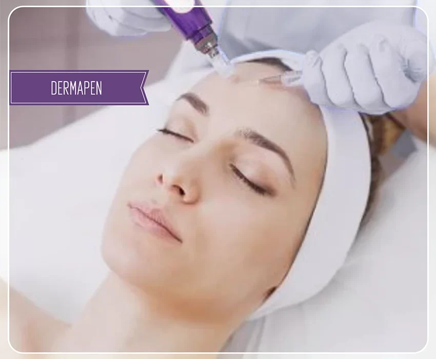Tratamiento Dermapen