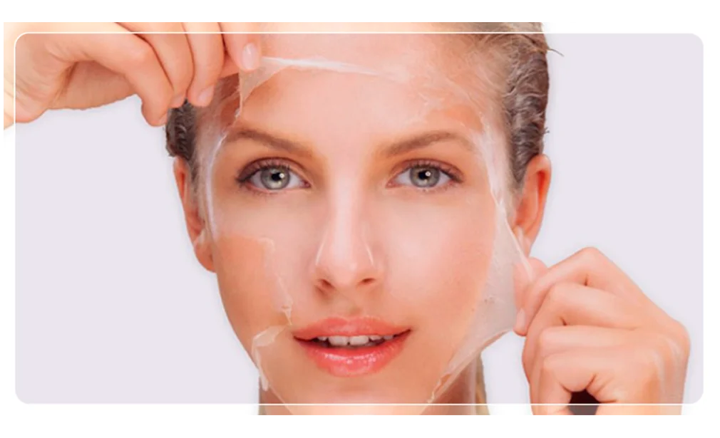 Peeling Químico